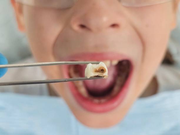 Best Emergency Denture Repair in Middlebury, IN